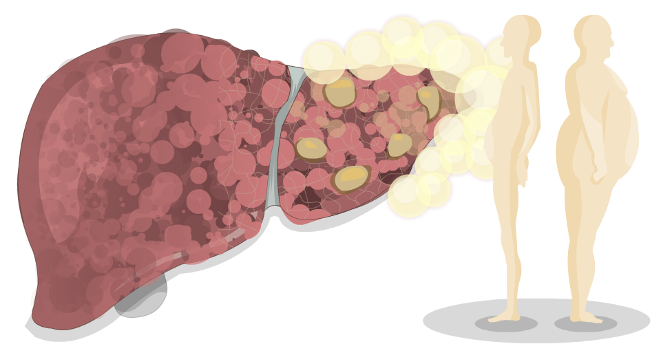 Liver visual data 7